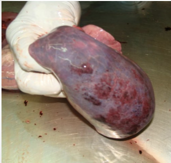 <p><span>caused by extreme chest trauma; excess fluid interferes with gas exchange leading to hypoxia (e.g. explosions, traffic accidents, falls, sport injuries, falls)</span></p>