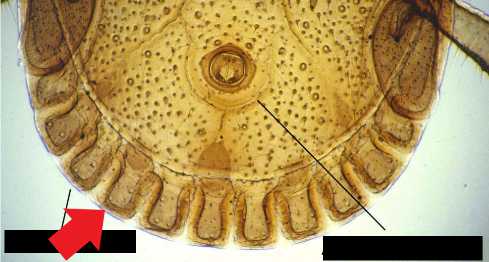 identify the pointed structure