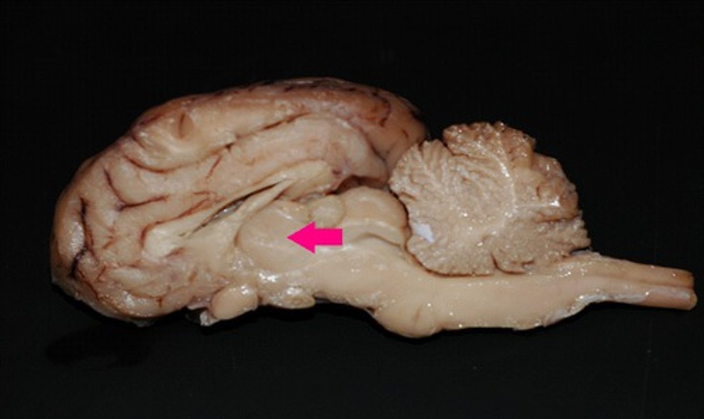 <p>Identify the structure.</p>