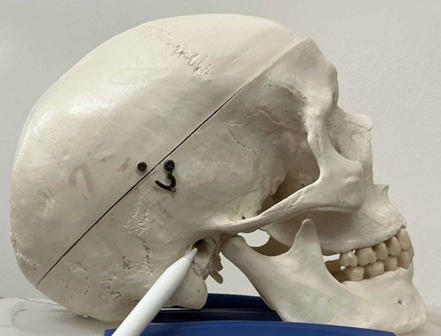 <p>What is the arrow pointing to?</p>