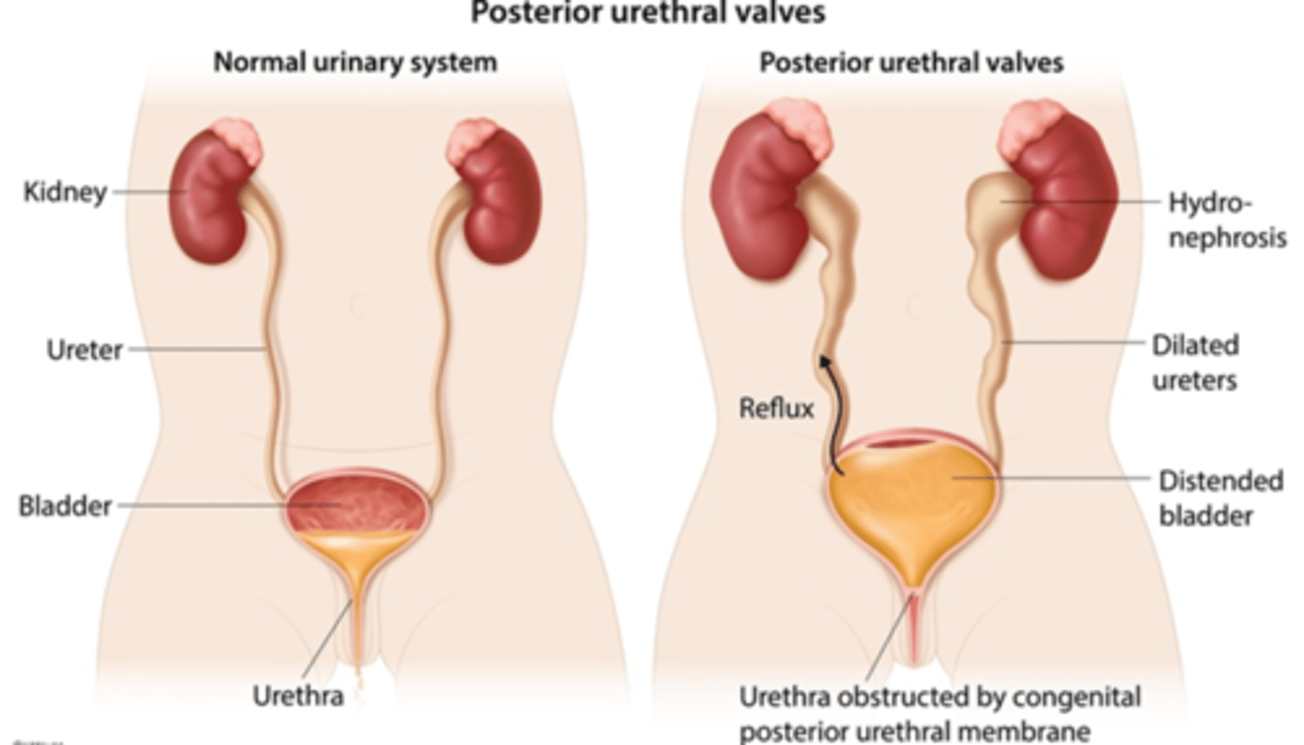 <p>STDs, constipation, bladder tumors</p>