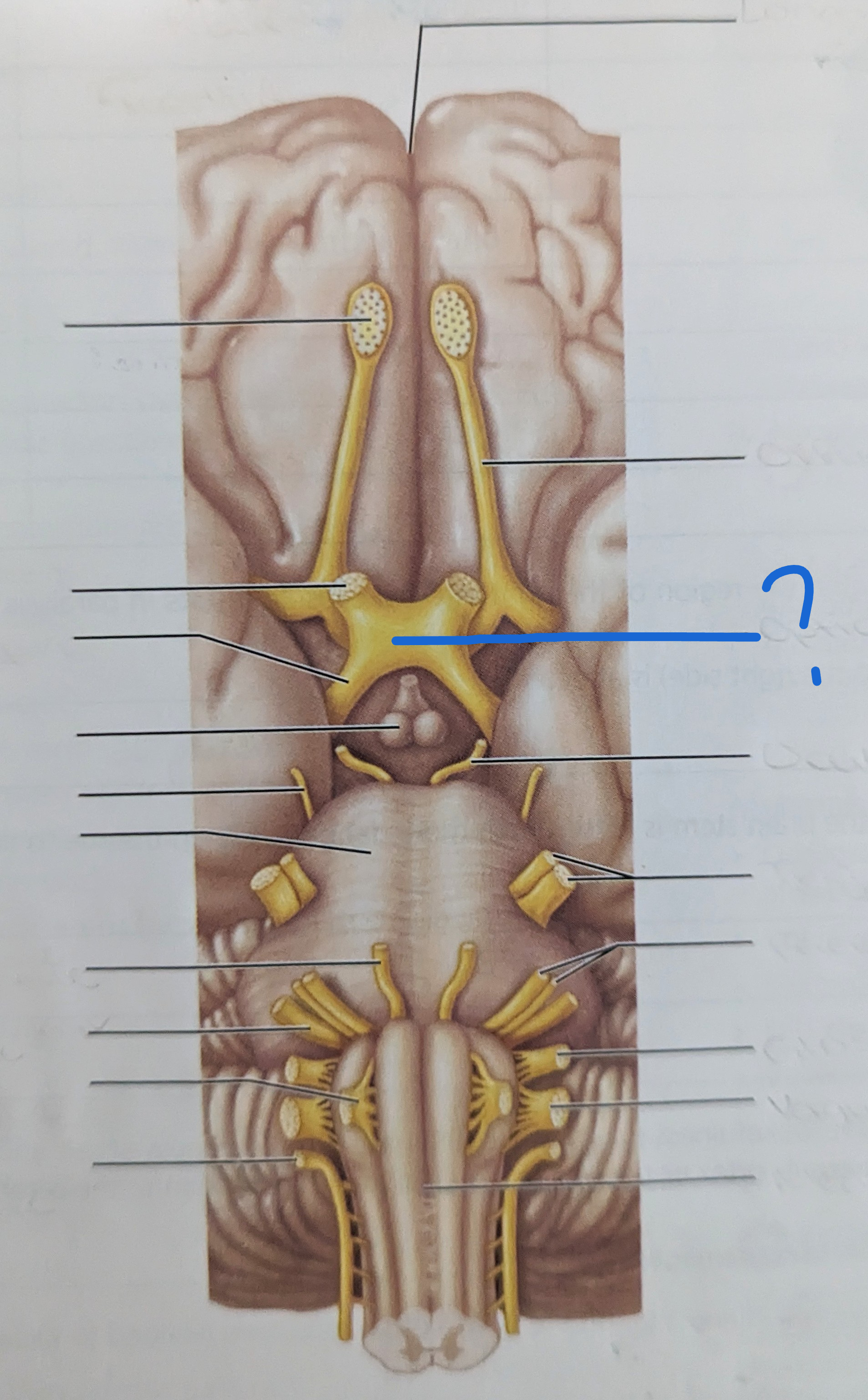 <p>What is the name of this?</p>