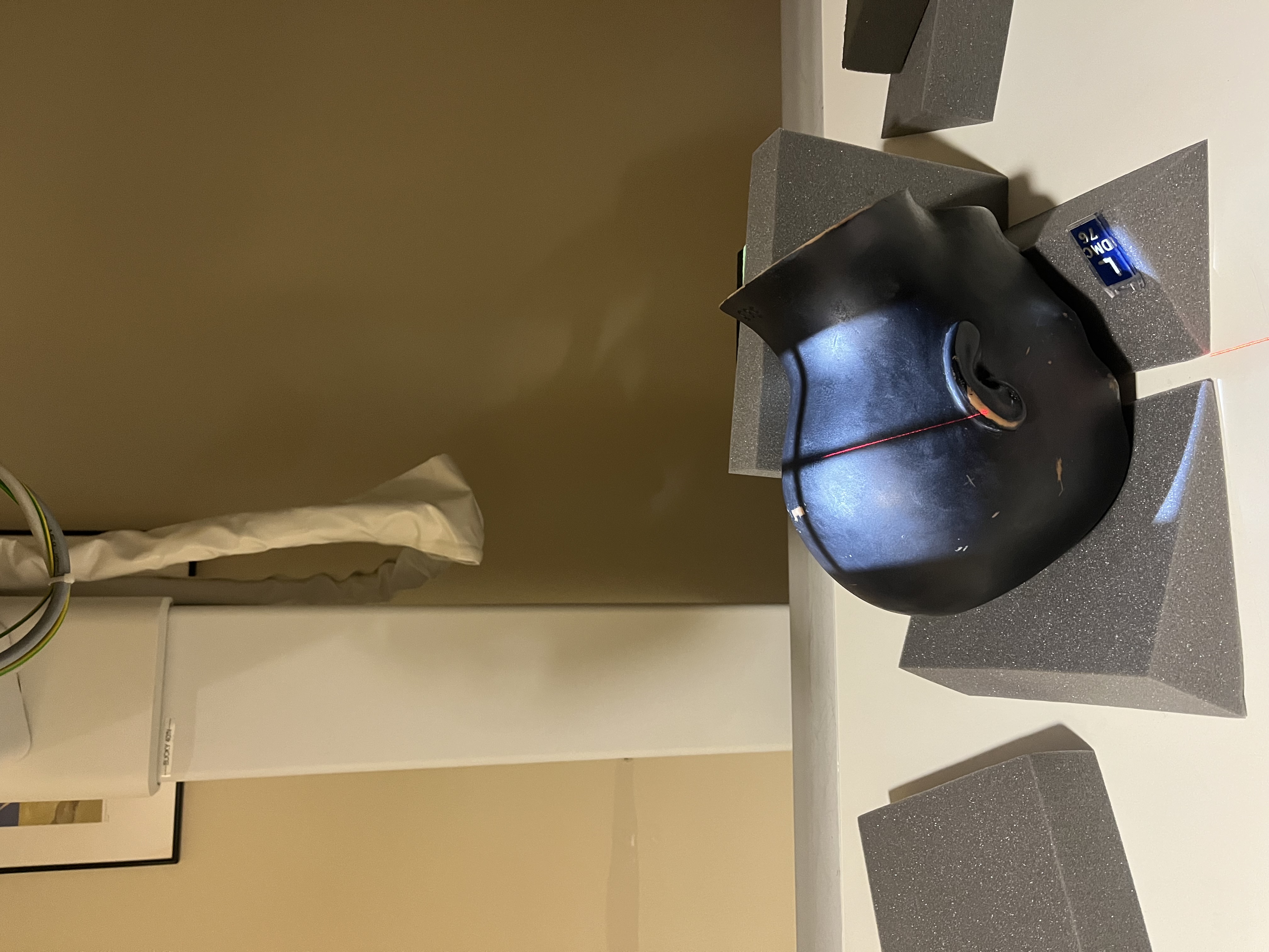 <p>PA AXIAL CALDWELL ; facial bones</p><p>SID</p><p style="text-align: start">COLLIMATION</p><p style="text-align: start">CR</p><p style="text-align: start">TECHNIQUE</p>