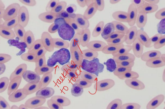 <ul><li><p><strong>ID: Lg, round </strong>to amoeboid cell <strong>w/ lg bluish cytoplasm w/ vacuoles</strong></p></li><li><p><strong>MOA:</strong> antigen processing, Bacti phagocytosis, resp burst</p></li><li><p><strong>High: </strong>chlamydiosis, granulomas, necrosis</p></li></ul><p></p>