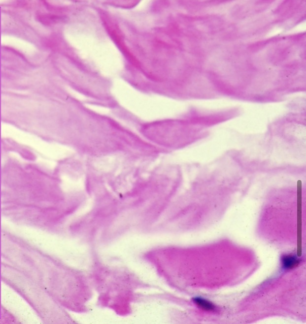 <p>Fibras de colágeno  </p>