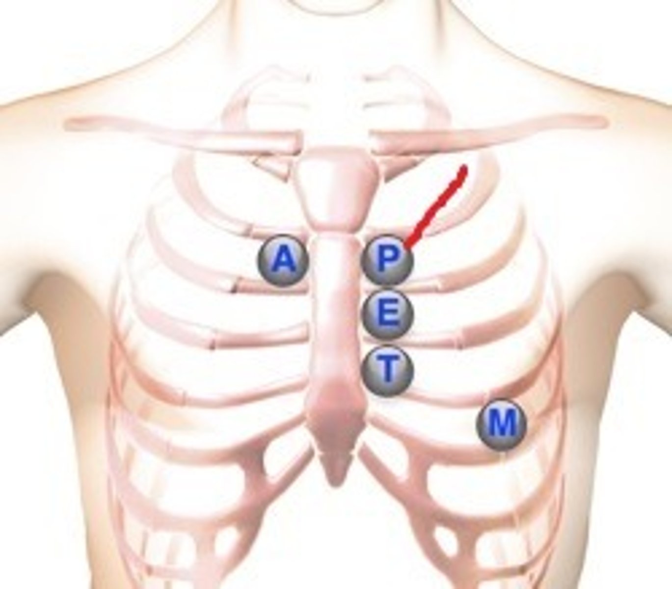 <p>2nd intercostal space, left sternal border</p>