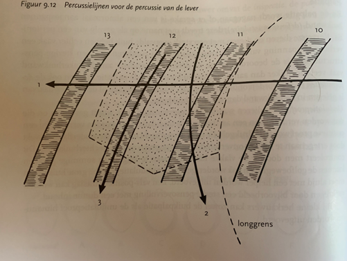 <p><strong>Inspectie</strong></p><ul><li><p>Symmetrie</p><ul><li><p>LDR: asymmetrisch, uitgesproken dik aan de rechterzijde</p><ul><li><p>Beginstadium: vooral rechteronderflank uitgezet</p></li><li><p>Afsluiting van lebmaag: uitzetting in de rechterbovenflank, vlak achter de ribboog</p></li></ul></li></ul></li></ul><p></p><p><strong>Palpatie</strong></p><ul><li><p>Hoek tussen de lendenwervels en de laatste rib</p><ul><li><p>LDR: voelbaar in deze regio als het ver genoeg gedisloceerd is</p></li><li><p>Sterke dilatatie: verder naar caudaal</p></li></ul></li></ul><p></p><p><strong>Auscultatie</strong></p><ul><li><p>Locatie: op de laatste ribben, ongeveer halverwege</p></li><li><p>Geen hulp van pensgeluiden, want je zit aan de rechterkant!</p></li><li><p>Hoogtonige borborygmi</p><ul><li><p>Afsluiting: geen geluiden</p></li></ul></li></ul><p></p><p><strong>Steelband</strong></p><ul><li><p>Uitvoering: percuteren tijdens auscultatie (percussiehamer of vingers)</p><ul><li><p>Positief: hoogtonige ‘pieng-pieng’ geluiden → gas aanwezig</p></li></ul></li><li><p>LDR: positief</p><ul><li><p>Sterk uitgezette colondelen of een mat gas overvuld caecum kunnen ook een positieve uitslag geven</p></li></ul></li></ul><p></p><p><strong>Klotsen</strong></p><ul><li><p>Uitvoering: stotende bewegingen in de rechteronderflank vlak achter de ribboog</p><ul><li><p>Positief: hoogtonige, klotsende geluiden</p><ul><li><p>Vloeistoflaag wordt in beweging gebracht</p></li></ul></li></ul></li><li><p>LDR: positief</p><ul><li><p>Sterk uitgezette, met vocht en gas gevulde darmdelen kunnen ook voor een positief resultaat zorgen</p></li></ul></li></ul><p></p><p><strong>Leverpercussie</strong></p><ul><li><p>Uitvoering</p><ul><li><p>1e percussielijn: horizontale lijn even onder de rugstrekkers totdat je een tympanisch toon van de buikholte hoort</p></li><li><p>2e percussielijn: vanuit de leverdemping langs de achtergrens van het longveld</p></li><li><p>3e percussielijn: over of langs de rib die in het percussieveld is gelegen</p></li></ul></li><li><p>LDR: verkleind of afwezig</p><ul><li><p>Lebmaag zit tussen de lever en de buikwand</p></li></ul></li></ul><p></p><p><strong>Rectaal onderzoek</strong></p><ul><li><p>Vaak met zekerheid te diagnosticeren</p></li><li><p>Lucht in de lebmaag of darm</p></li></ul>