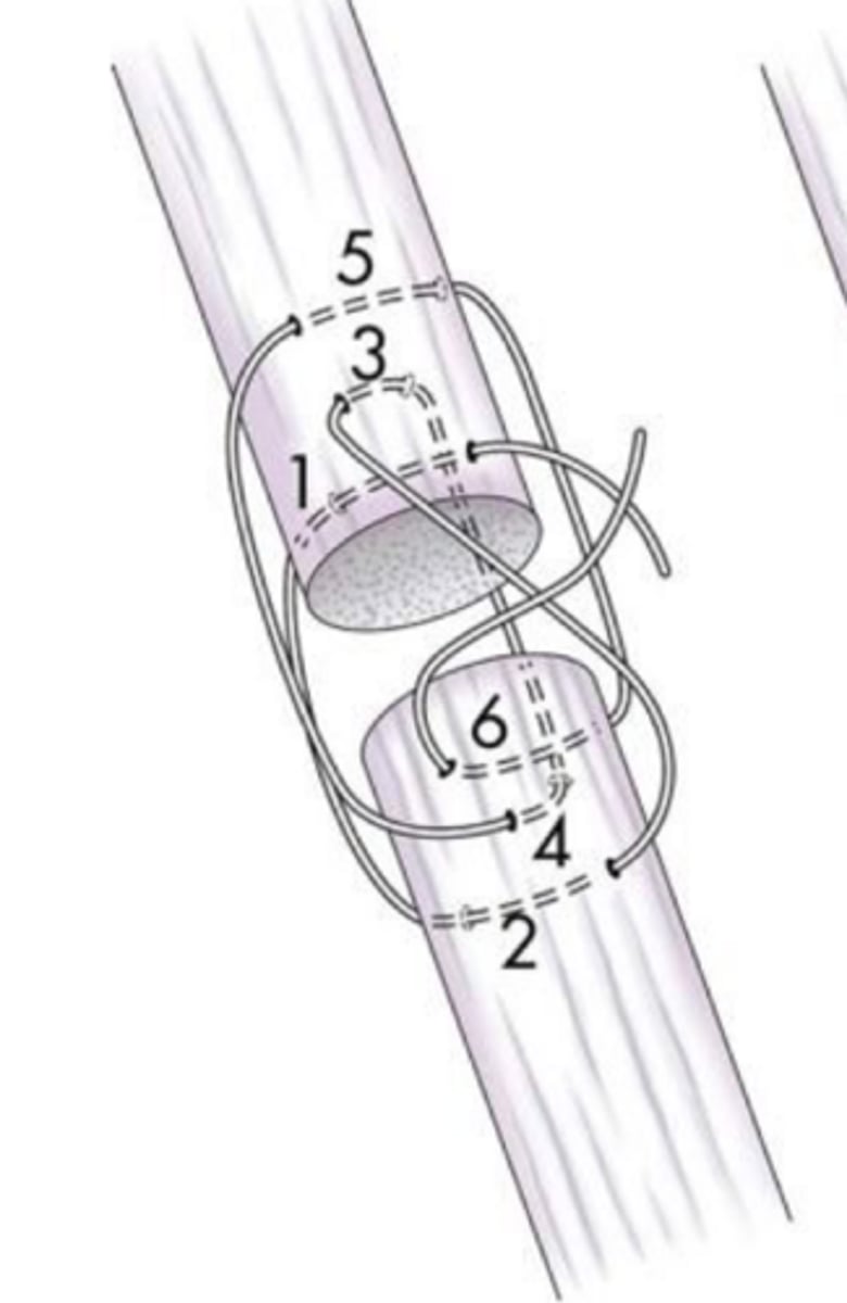 <p>what ligament/tendon suture pattern is shown here that is ideal for round tendon/ligaments</p>