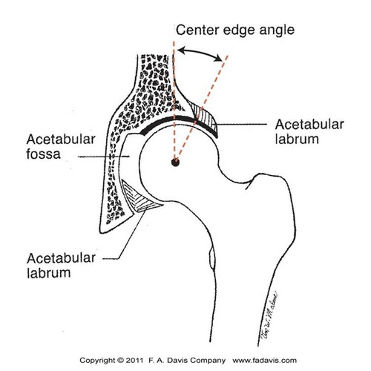 <p>the degree to which the acetabulum covers the femoral head</p>