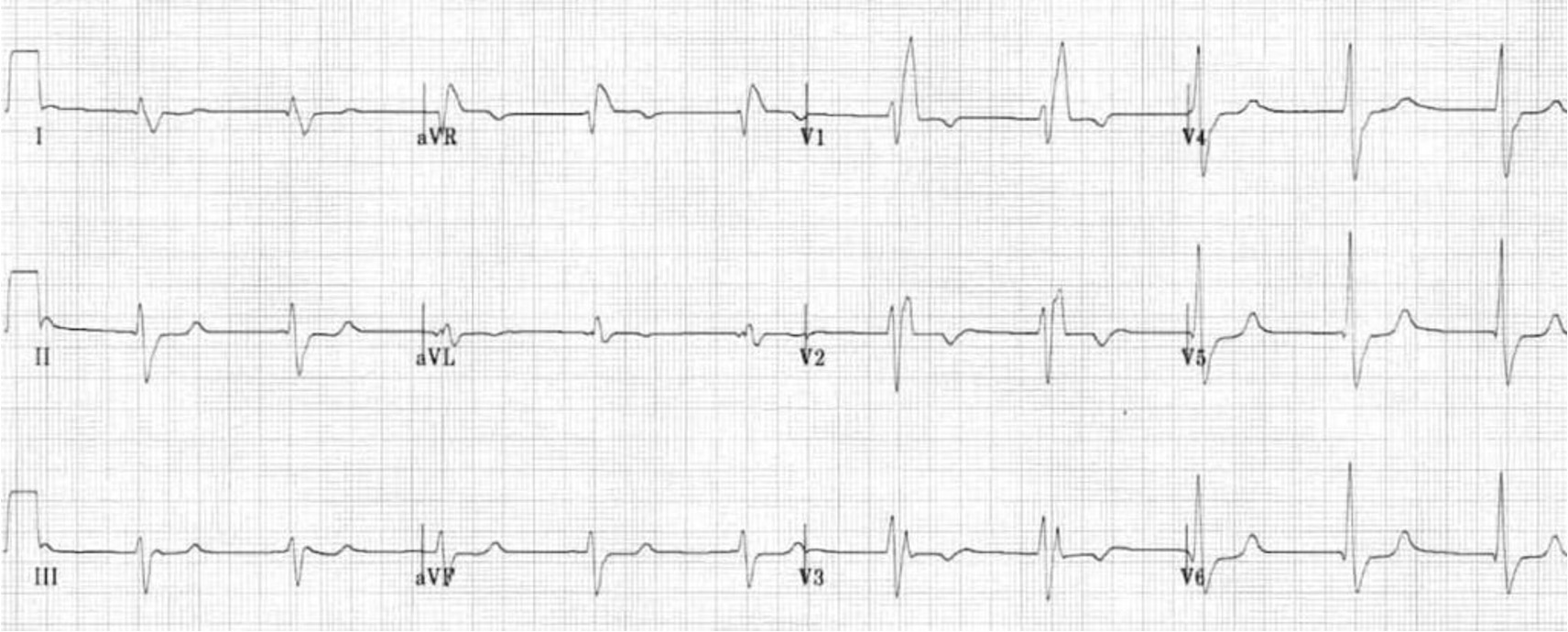 <p>what is this?</p>