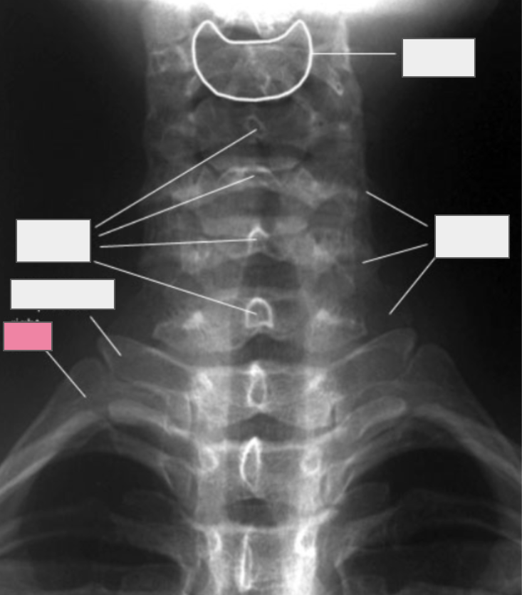 <p>What structure of the spine does the box highlighted in pink reference to?</p>