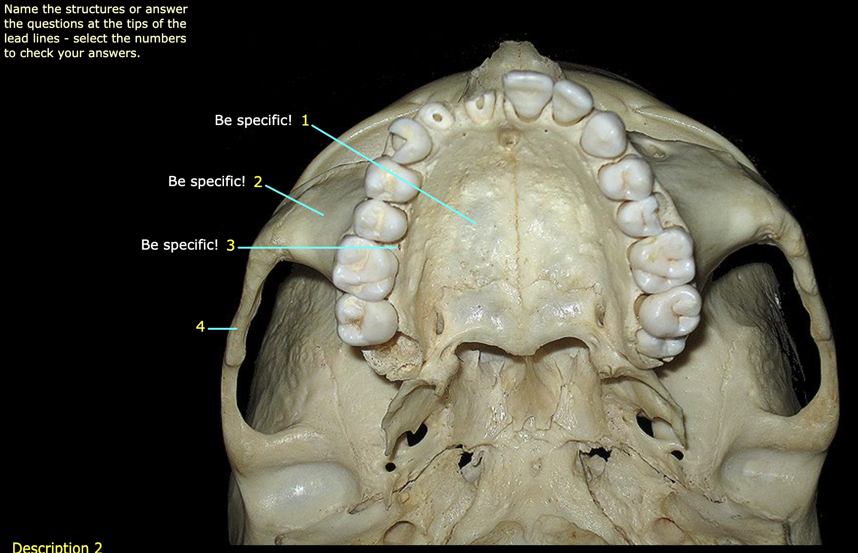 What structure is labeled 1?