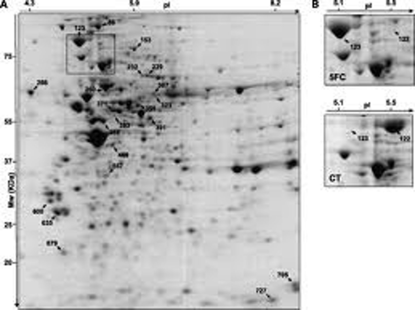 <p>Also known as 2-D electrophoresis, begins with 1-D electrophoresis but then separates the molecules by a second property in a direction 90 degrees from the first. In 1-D electrophoresis, proteins (or other molecules) are separated in one dimension, so that all the proteins/molecules will lie along a lane but that the molecules are spread out across a 2-D gel. Because it is unlikely that two molecules will be similar in two distinct properties, molecules are more effectively separated in 2-D electrophoresis than in 1-D electrophoresis.</p>