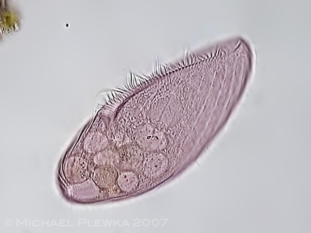 <p>what is this bacteria?</p>