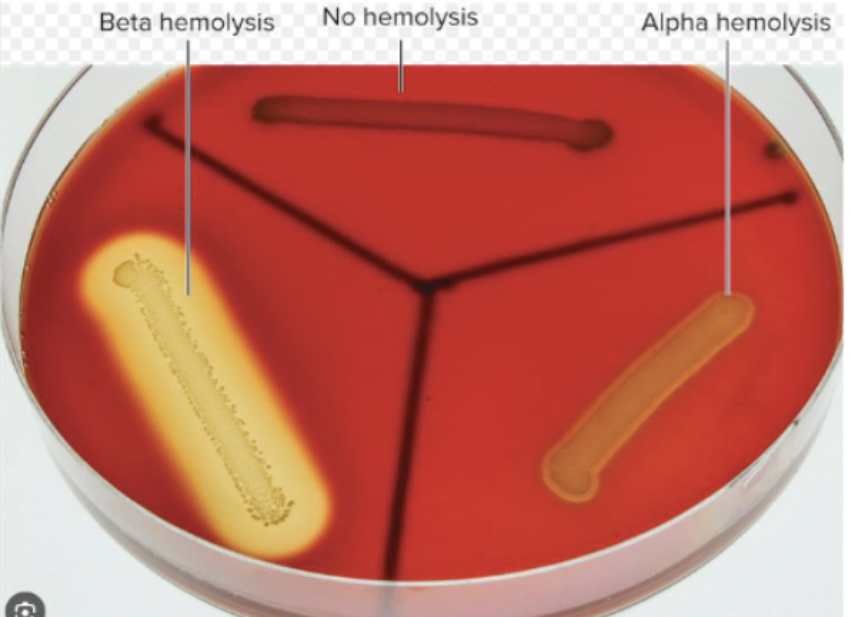 <p>Type: Enrichment and Differential </p><p>Used to culture fastidious (<span><span>microorganisms that have complex or particular nutritional requirements and are difficult to grow in a laboratory) </span></span>microorganisms and detect hemolysis </p><p></p><p>Differential: Different types of hemolysis </p><p></p><p>alpha- hemolysis: partial hemolysis, greenish opaque zone (beige)</p><p>beta-hemolysis: complete hemolysis, clear zone (ate up the RBC in agar) (bright yellow)</p><p>gamma- hemolysis: no hemolysis (dark red)</p>