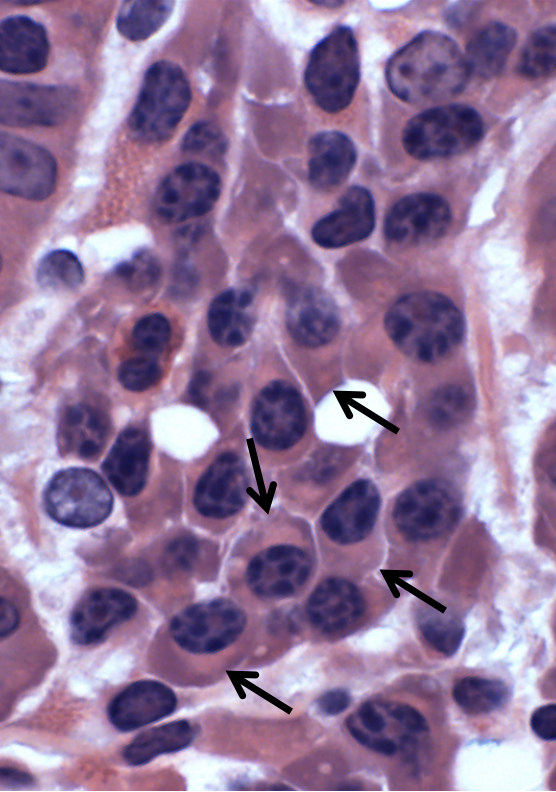 <p>What cells are shown at the black arrows?</p>