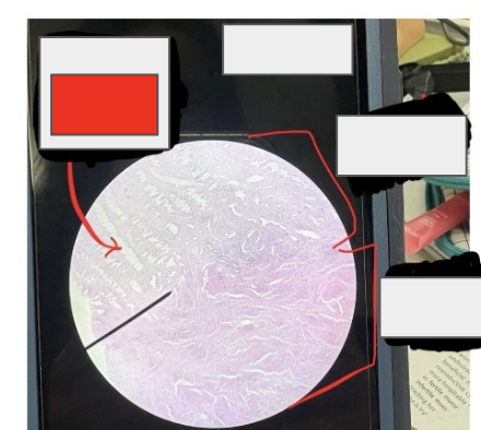 <ol><li><p>What is this?</p></li><li><p>What type of tissue would you find here?</p></li></ol><p></p>