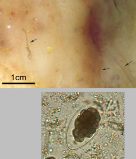 <p>What is this abomasal parasite? How is it diagnosed (2)</p>