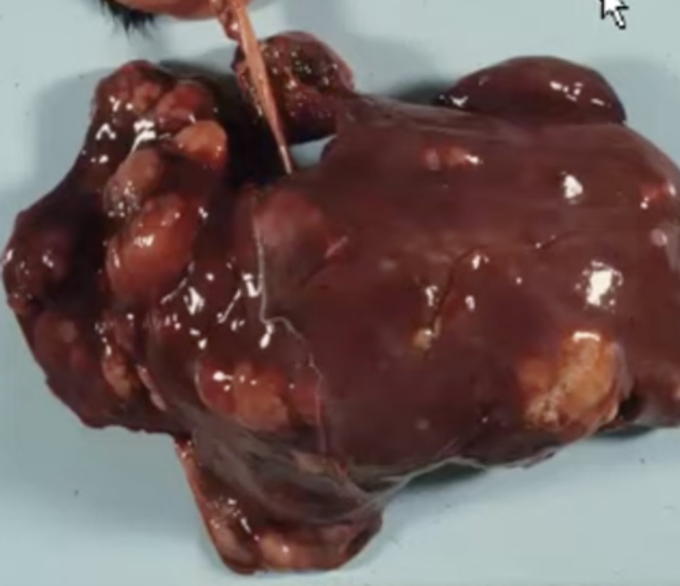 <p>What has caused this gross appearance of this bovine liver?</p>