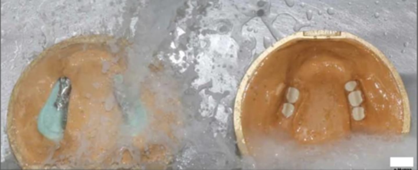 <p>ID the phase:</p>