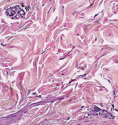 <p>Label the Dense Irregular CT</p>