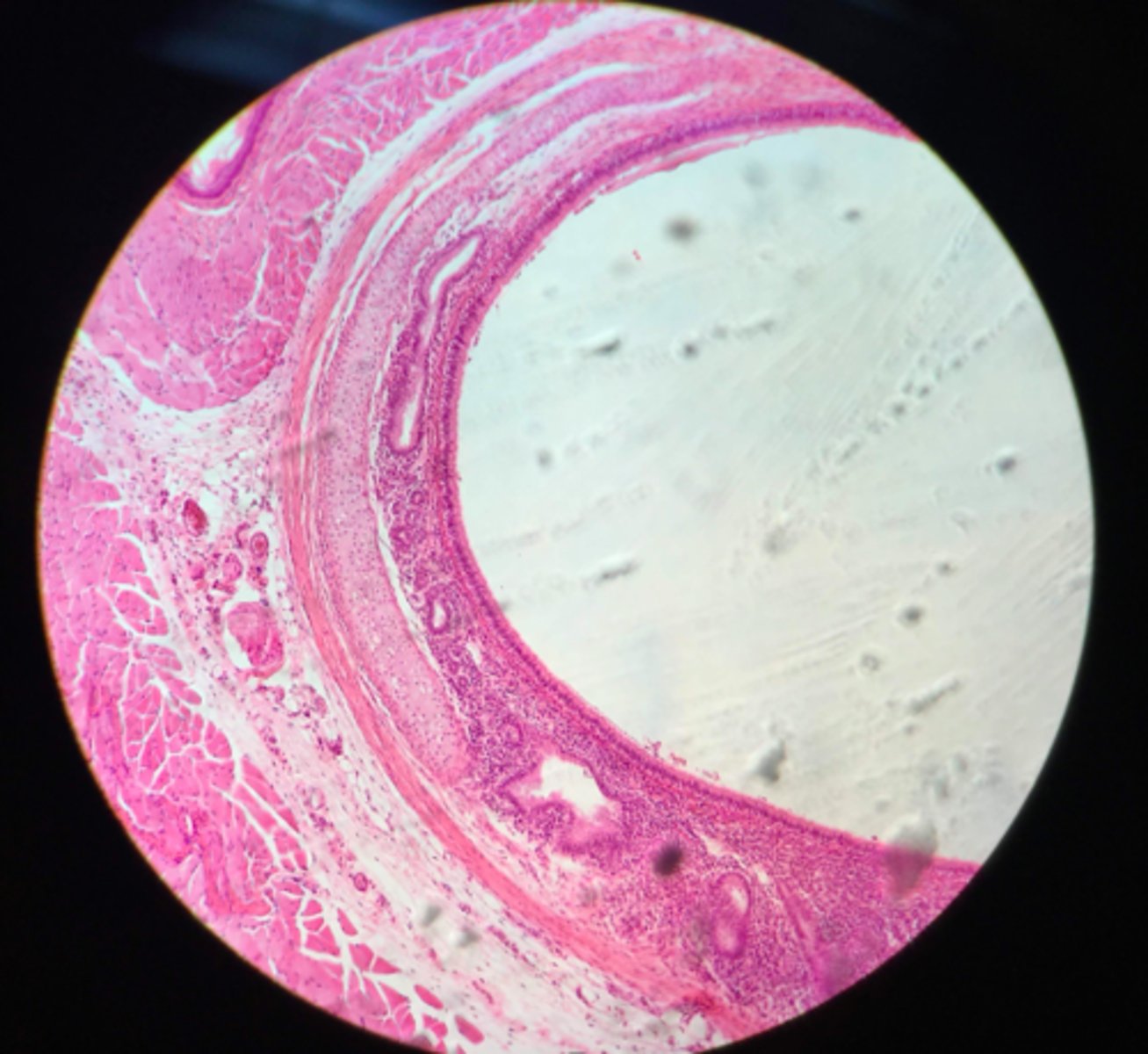 <p>What organ is shown on this microscope slide?</p>