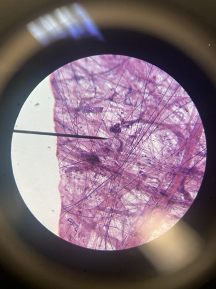 <p>What type of tissue</p>