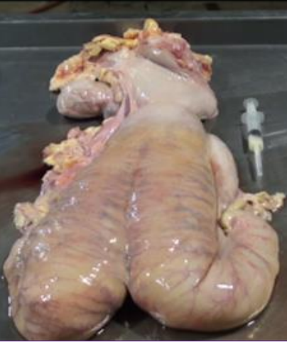 <p>What is this?</p><p>Why does it occur?</p>