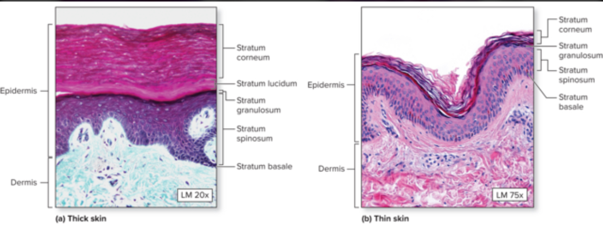 <p>Each skin layer is thicker and has one extra layer = stratum lucidum</p><p>Epidermis ridge present</p><p>Location: fingertips, palms of hands, soles of feet</p>
