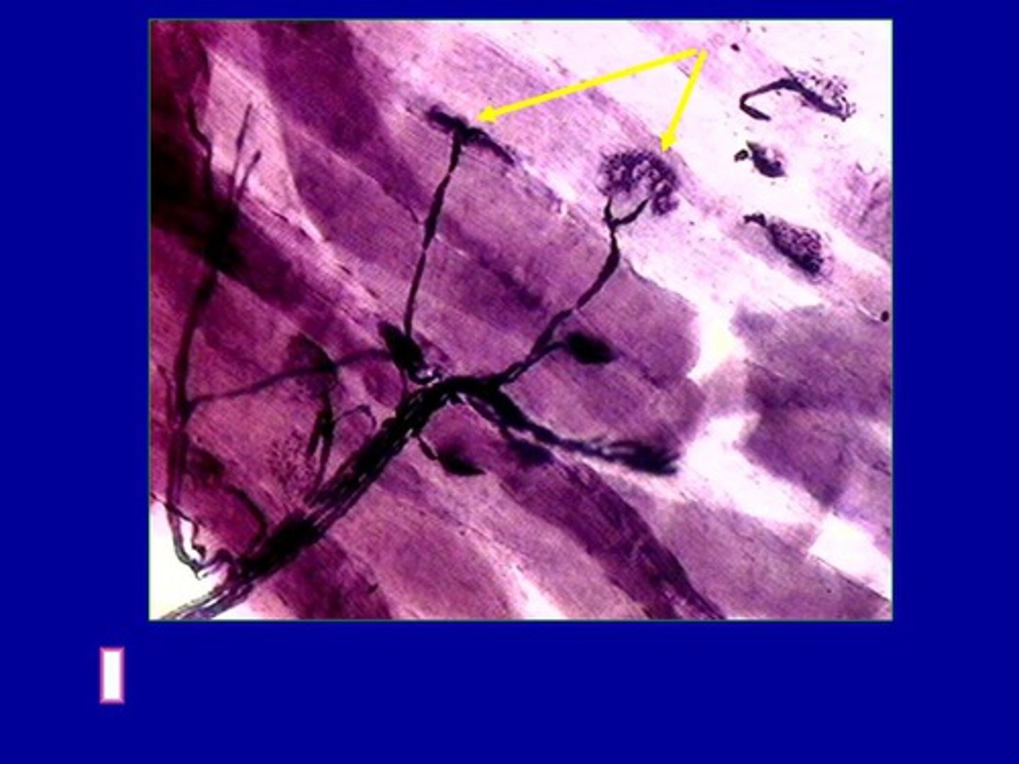 <p>Sites where a motor neuron's axon terminus synapses with multiple skeletal muscle fibers (junction between 2 muscles). These form multiple synapses despite the fact that each muscle cell receives a single synapse.</p>