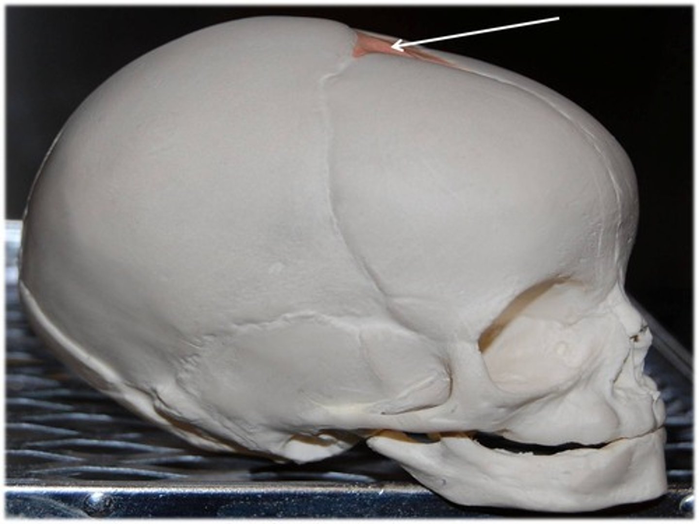 <p>What bone is this?</p>