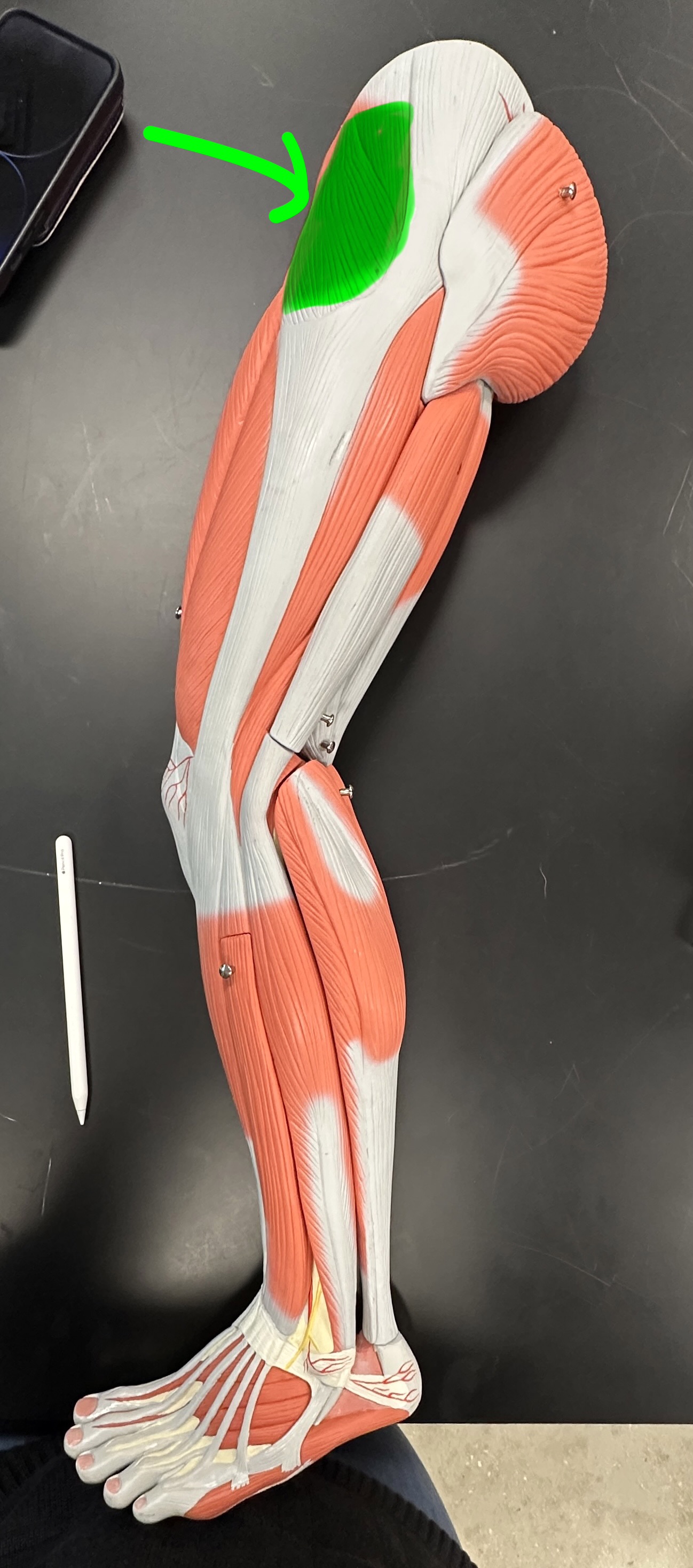 <p>What is the highlighted structure</p>