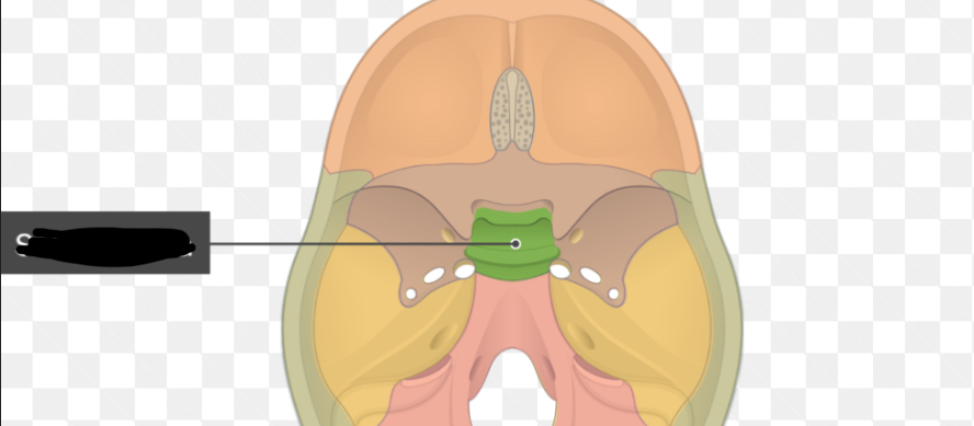 term image