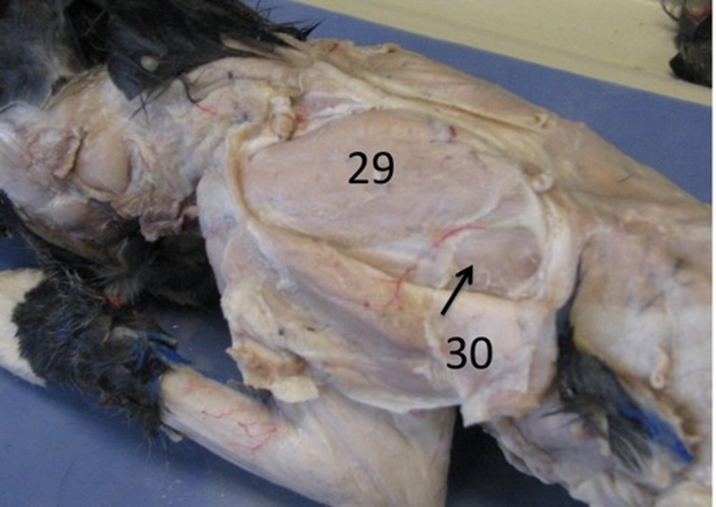 <p>name this muscle (29)</p>