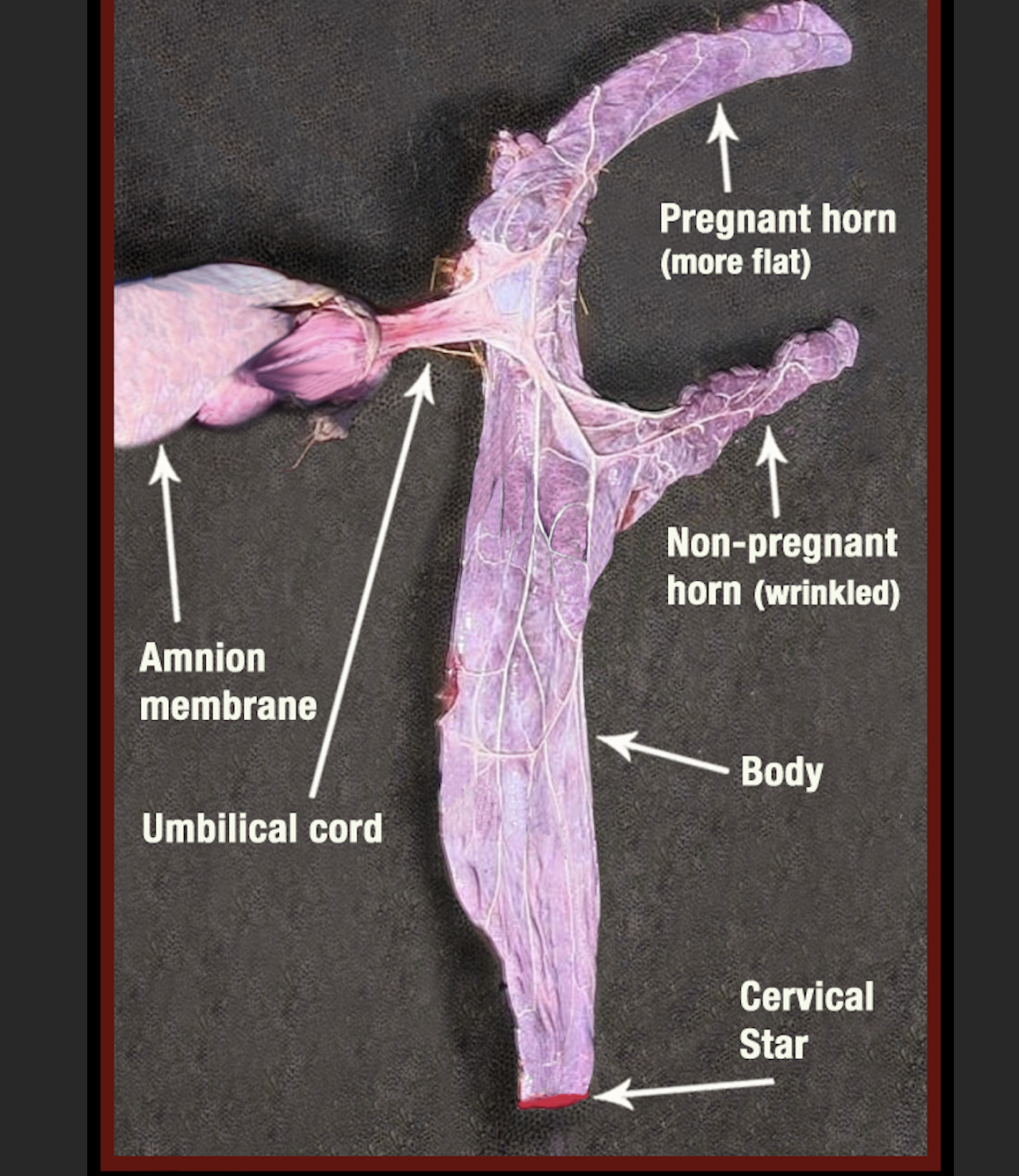 <p>Cervical Star Picture</p>