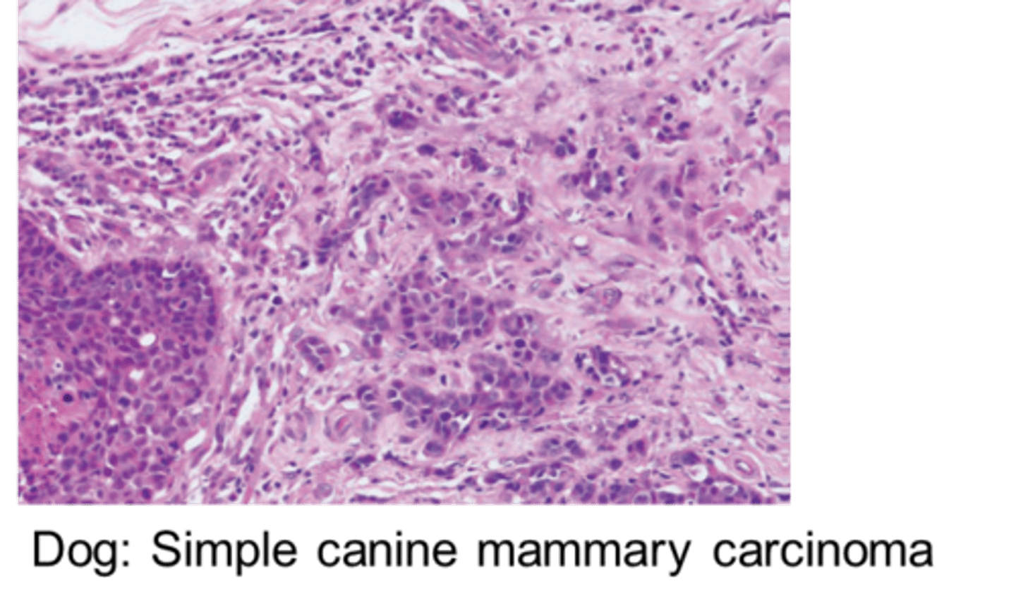 <p>Large number of subtypes, wide heterogeneity taken into account by the grading of different factors:</p><p>Differentiation, tubule formation, nuclear pleomorphism, mitoses per 10 HPF. The anaplasia, the high nuclear grade and mitotic rate are negative prognostic factors, as well as the stromal invasion and the presence of neoplastic emboli.</p>