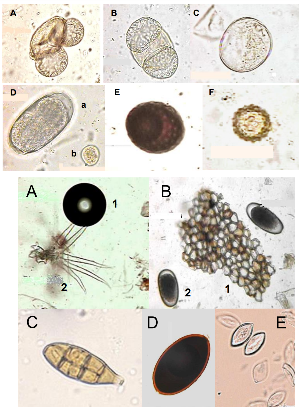 <p>Organisms (organic/anorganic substances) that may resemble parasites but do not rely on a host for their life cycle, nor are they actual parasites.</p><ul><li><p><strong>similar to the propagation stages of parasites</strong> (egg, cyst, larvae)</p></li><li><p><strong>non-parasitic substances: </strong>plant fibre, hairs, pollen grain (AF), mucosal cells, cells of plants (B1), air bubble (A1)</p></li><li><p><strong>non-specific parasitic objects: </strong></p><ul><li><p>monocystis sp. - protozoa from earthworms</p></li><li><p>eggs + larvae of parasites that came from another host after ingestion of feces. Like for instance pig ingesting faces of poultry or dogs eating ruminant faeces. </p></li></ul></li></ul><p></p>