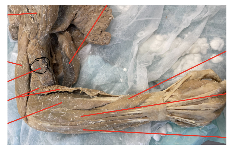 <p>what muscle does the marked image represent?</p>