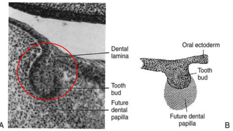 <p>a band of epithelial tissue that covers the embryonic jaw and grows into the developing gums. it also gives rise to the enamel organs of the teeth. </p>