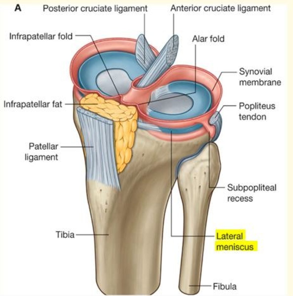 <p>Crescent-shaped fibrocartilage</p><p>Deepens the articular surface of tibia - gives stability</p><p>Functions as a shock absorber</p><p>1) Medial meniscus</p><p>2) Lateral meniscus </p>