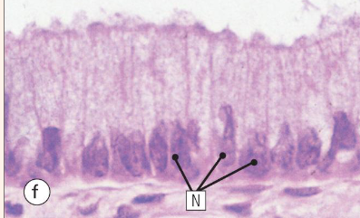 <p>what type of epithelium is shown here</p>
