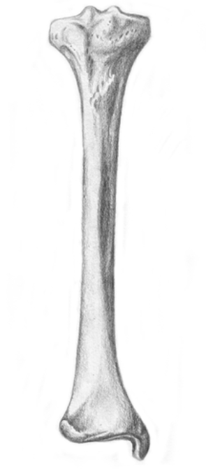 <p>What bone is this?</p>
