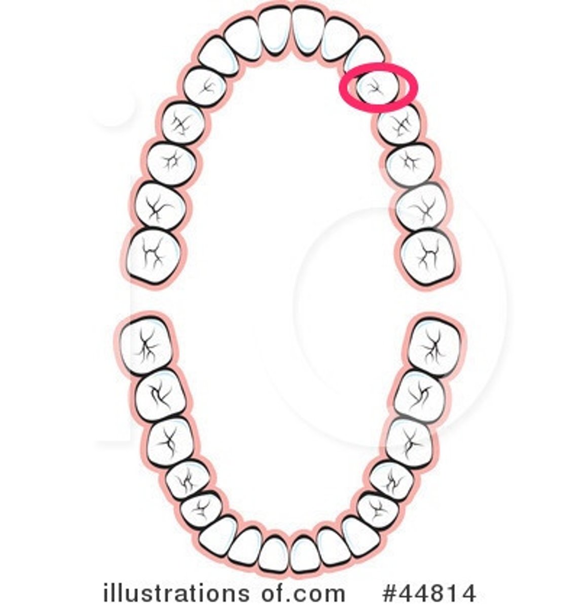 <p>UL 1st premolar</p>