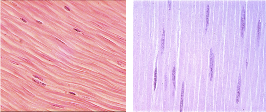 <p>Muscle tissue found in blood vessels and the GI tract for involuntary movement.</p>