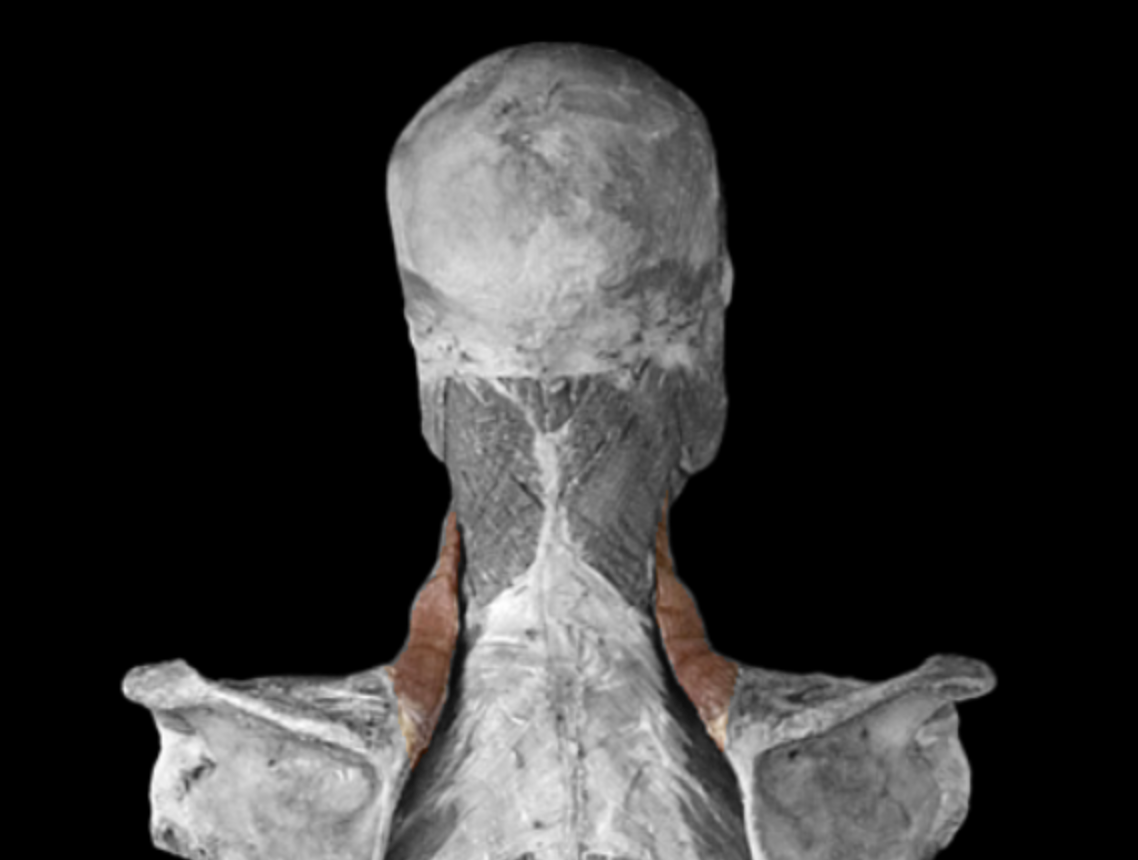 <p>What muscle is this? </p>