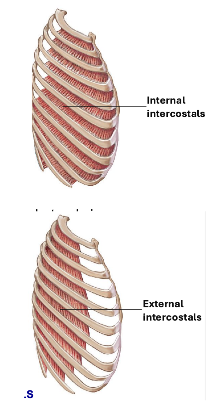 <p>thoracic muscles associated w rib cage </p><ul><li><p><span style="background-color: transparent;"><u><span>Internal intercostal</span></u><span>: depress ribs during expiration </span></span></p></li><li><p><span style="background-color: transparent;"><span>⤷ </span><strong><span>job</span></strong><span>: pull inferior ribs back into place </span></span></p></li><li><p><span style="background-color: transparent;"><span>⤷ deeper muscles than external intercostals</span></span></p></li><li><p><span style="background-color: transparent;"><span>⤷ DIR of muscles = perpendicular to “hands in pocket”</span></span></p></li></ul><p></p>