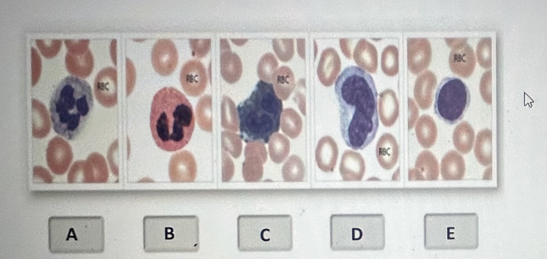 Identify the white blood cell labeled D