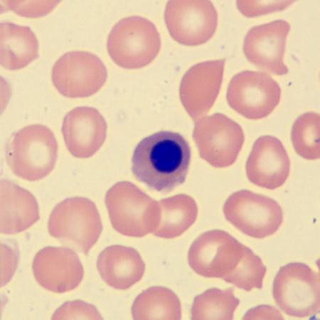 <p>What is this erythrocyte?</p>