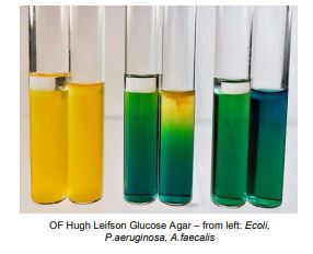 <p>Label this OF test</p>