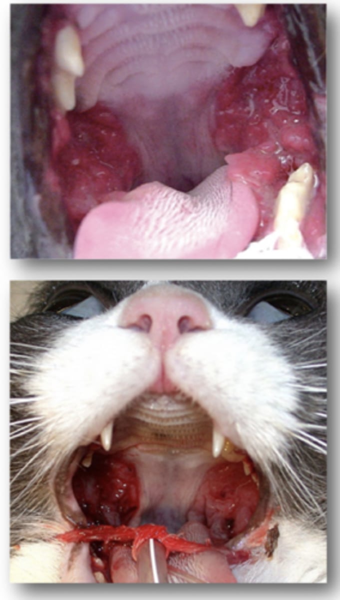 <p><strong>Progressively Worsening inflammation of Oral Mucosal Tissue</strong></p>